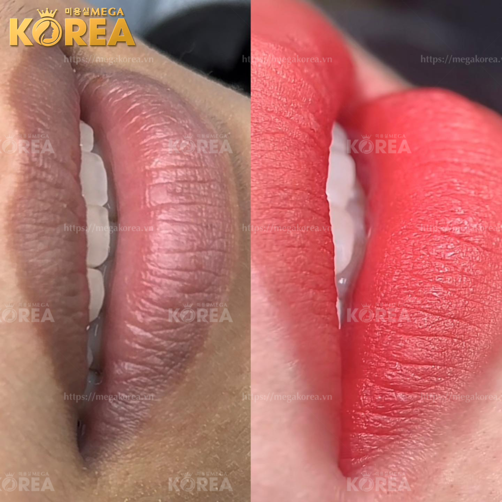 Phun môi tại Mega Korea