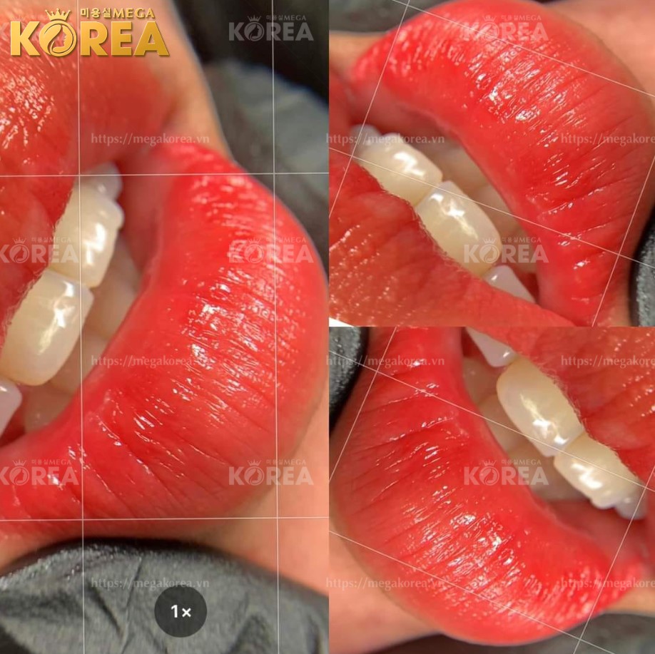 Feedback phun xăm môi tại Mega Korea